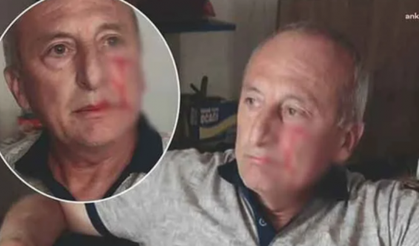 CHP'li belediye başkanına saldırı!